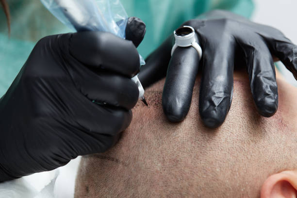 istock Cosmetologist making permanent makeup on man head - tricopigmentation 639042430