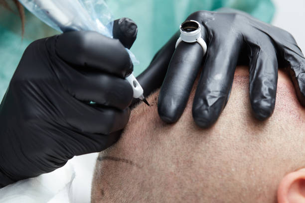 istock Cosmetologist making permanent makeup on man head - tricopigmentation 639042482