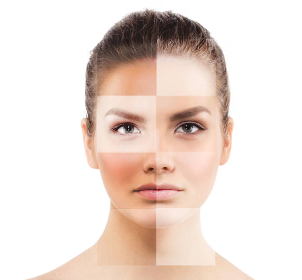 istock Portrait woman with problem and clear skin. Studio shot. 639052580