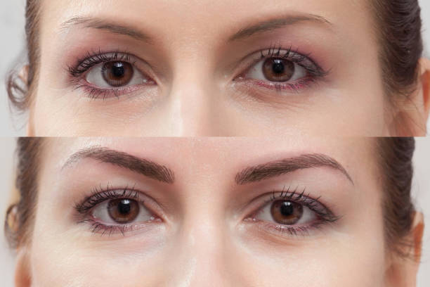 Eyebrow Tattooing Before and After
