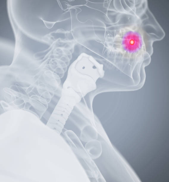 istock Toothache, pain. Human anatomy head xray like image. 639125424