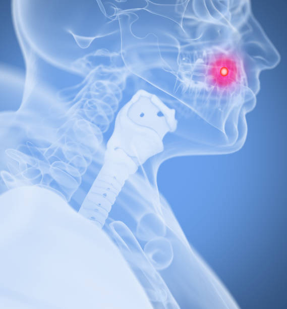 istock Toothache, pain. Human anatomy head xray like image. 639125736