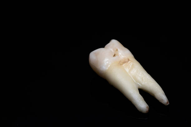 close-up of human tooth on a black background