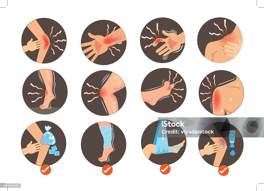 Sprains向量圖形及更多痛苦圖片 - 痛苦, 身體損傷, 傷口 - iStock