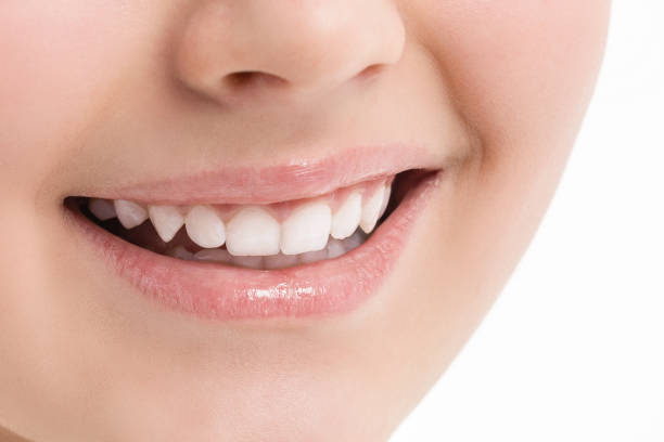 istock Female smile. Face. White teeth 639437526