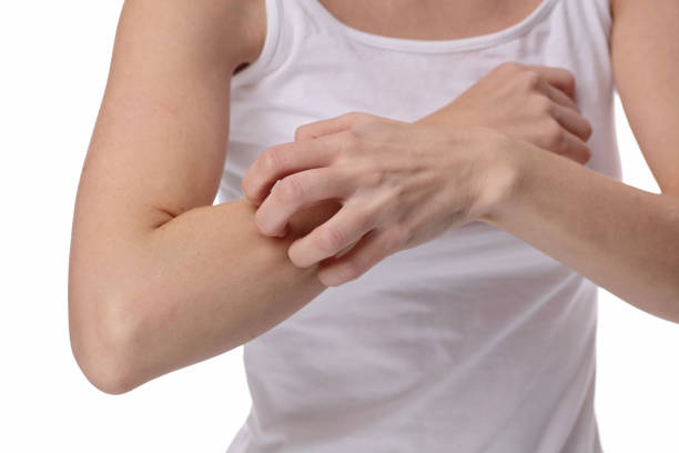 istock Woman Scratching an itch 639506658