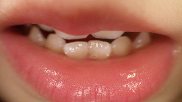 istock cute child tooth close up macro zoom 639624842