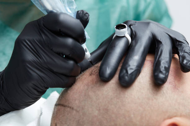 istock Cosmetologist making permanent makeup on man head - tricopigmentation 639703406