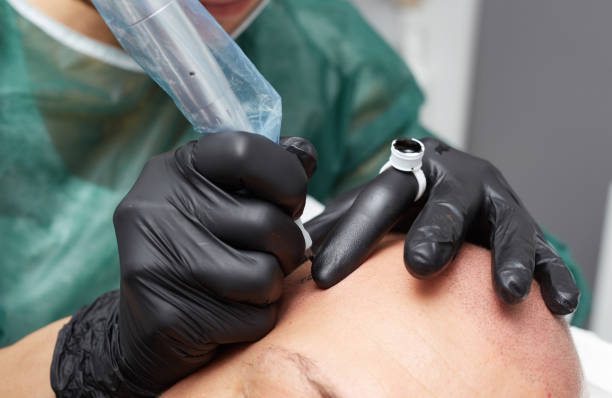 istock Cosmetologist making permanent makeup on man head - tricopigmentation 639703602