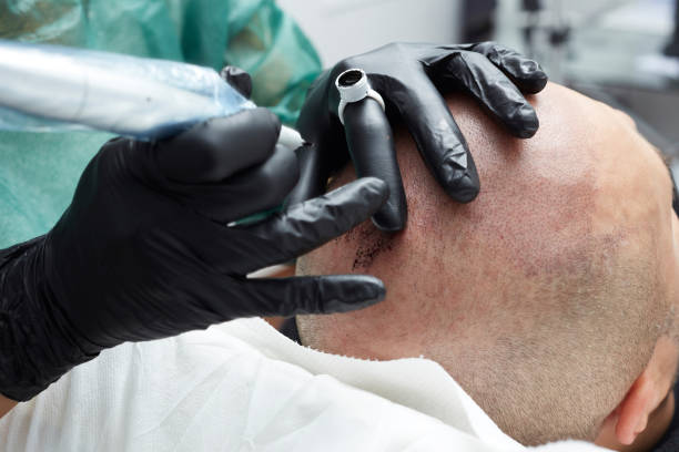 istock Cosmetologist making permanent makeup on man head - tricopigmentation 639703818