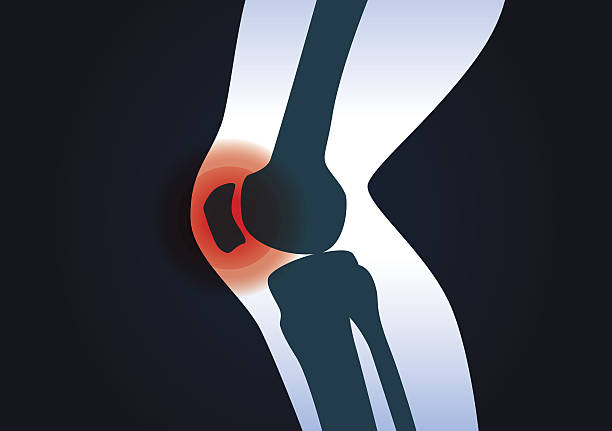 膝の領域に赤信号 - human muscle the human body anatomy body点のイラスト素材／クリップアート素材／マンガ素材／アイコン素材