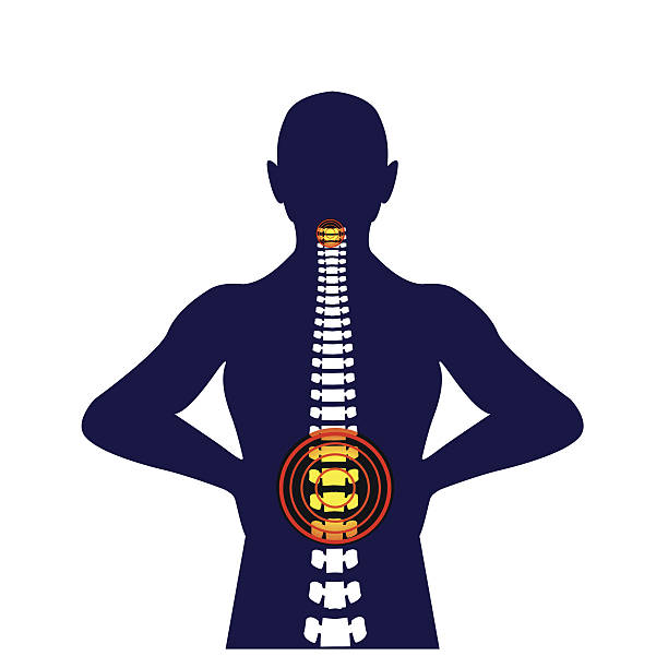 medizinisches konzept illustration der muskel-skelett-stamm rückenschmerzen - ischium stock-grafiken, -clipart, -cartoons und -symbole