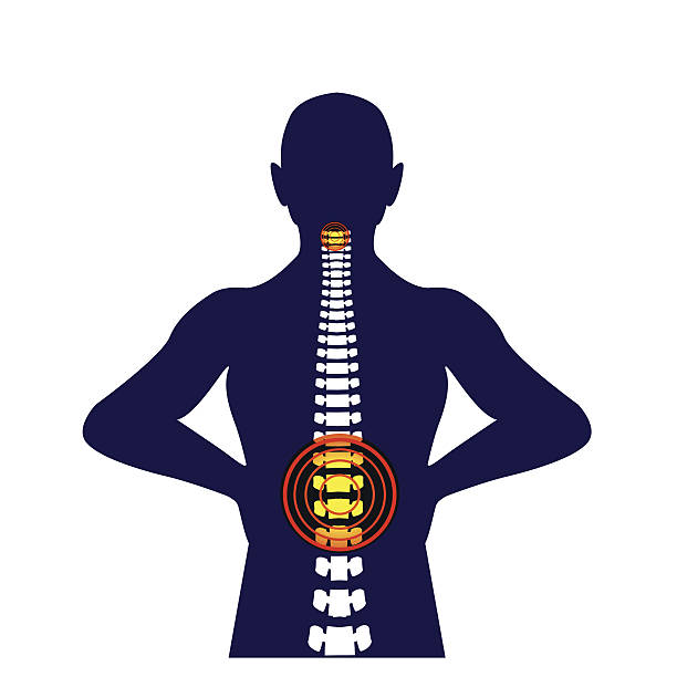 근골격계 변형 허리 통증의 의료 개념 그림 - ischium stock illustrations