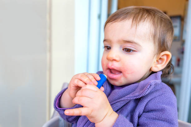 baby lip balm chapped lips cooled cracked dermatitis
