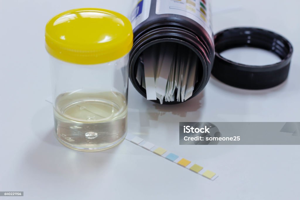 Urrine Sample Urine Sample Stock Photo - Download Image Now - Collection, Diabetes ...
