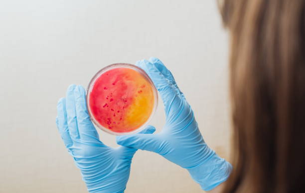 laboratory technician testing for bacterial infection - petri dish agar jelly laboratory glassware bacterium imagens e fotografias de stock