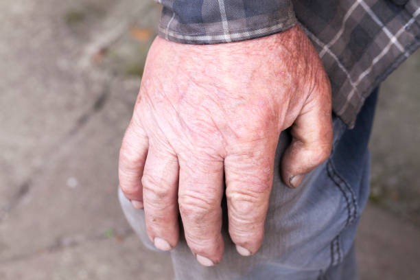 istock hand of an old man 640309488