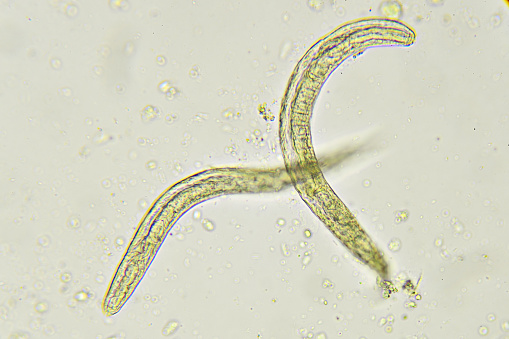 Strongyloides stercoralis (threadworm) in stool, analyze by microscope
