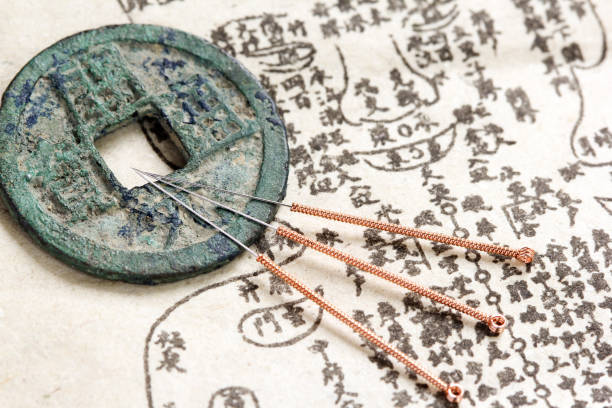 aiguilles d’acupuncture et de la médecine antique livre - acupuncture needle photos et images de collection