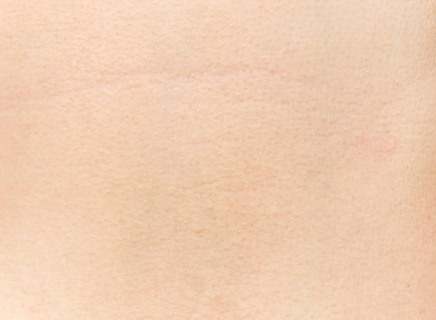 istock The texture of human skin 641087146