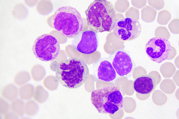 White blood cells White blood cells in peripheral blood smear, Wright stain white blood cell stock pictures, royalty-free photos & images