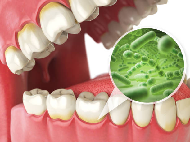 bakterien und viren um zahn. dental-hygiene medizinisches konzept. - zahnkaries stock-grafiken, -clipart, -cartoons und -symbole