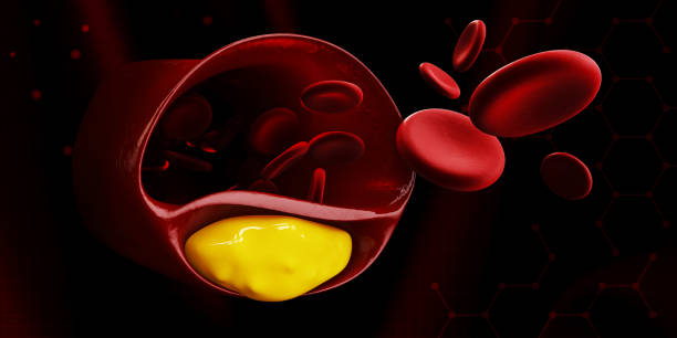 ilustración 3d de las células sanguíneas con la acumulación de placa de símbolo de colesterol de la enfermedad vascular. - rusk county fotografías e imágenes de stock