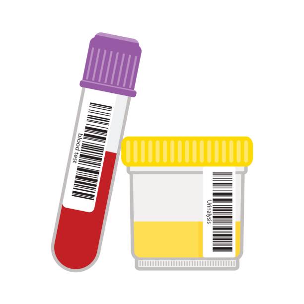 illustrazioni stock, clip art, cartoni animati e icone di tendenza di campioni di laboratorio di urina e sangue. - laboratory blood laboratory equipment medical sample