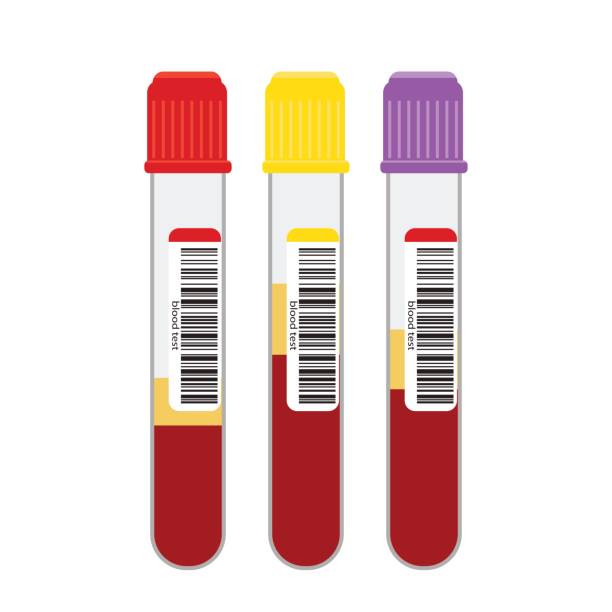 Blood samples in glass vials with a bar code .Blood sample in vitro. vector art illustration