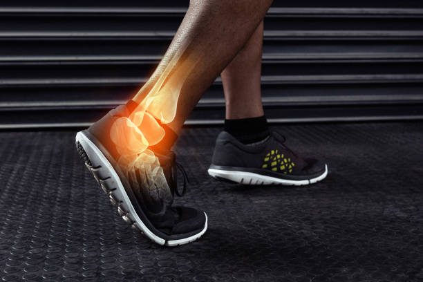 istock Struggling with an ankle injury 641859380