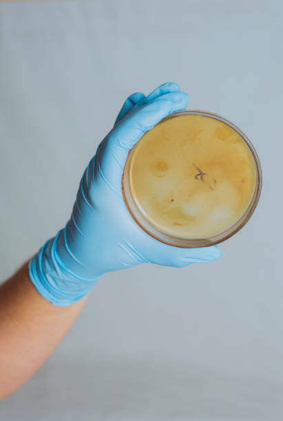 test per l'infezione batterica intestinale - bacterium staphylococcus colony epidemic foto e immagini stock