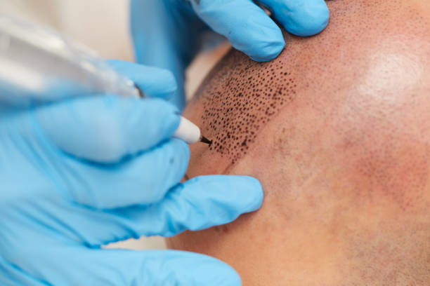 professional tattooist making permanent make up tricopigmentation MARTY fototesseraprofessional tattooist making permanent make up tricopigmentationprofessional tattooist making permanent make up tricopigmentation skinhead haircut stock pictures, royalty-free photos & images