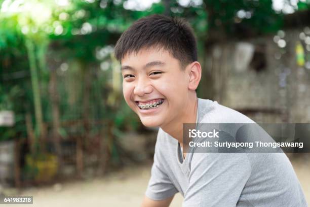 Photo libre de droit de Beau Sourire De Beau Garçon Avec Dents Orthèse Dentaire banque d'images et plus d'images libres de droit de Jeunes garçons