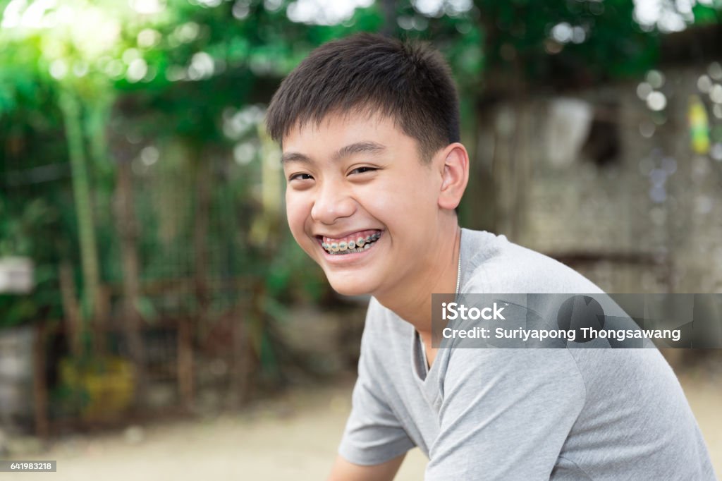 Beautiful smiling of handsome boy with teeth brace dental. Teenage Boys Stock Photo