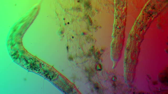 Microscopic worm - Oligochaeta Naididae