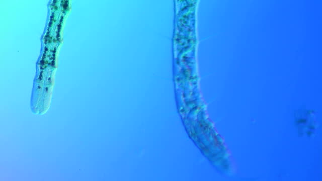 Microscopic worm - Oligochaeta Naididae