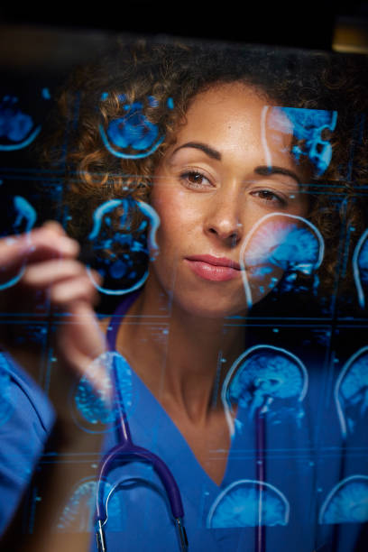 neurosurgeon checking mri scans a female doctor or surgeon is analysing the digitally generated scans of a human brain digital xray stock pictures, royalty-free photos & images