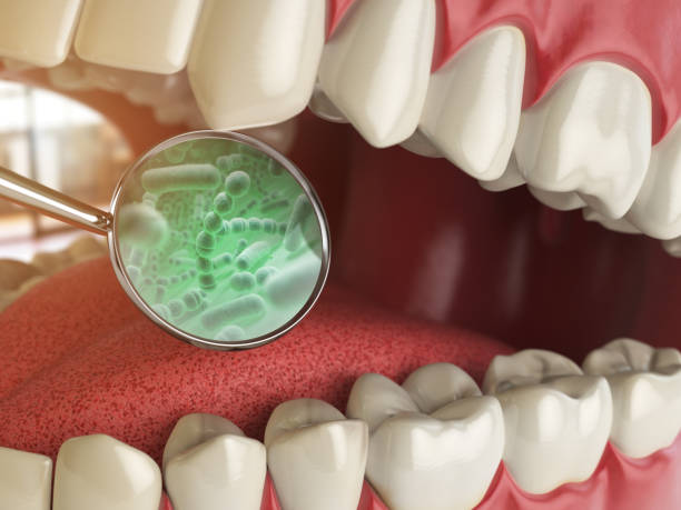 ilustraciones, imágenes clip art, dibujos animados e iconos de stock de bacterias y virus alrededor del diente. concepto médico de higiene dental. - bucal