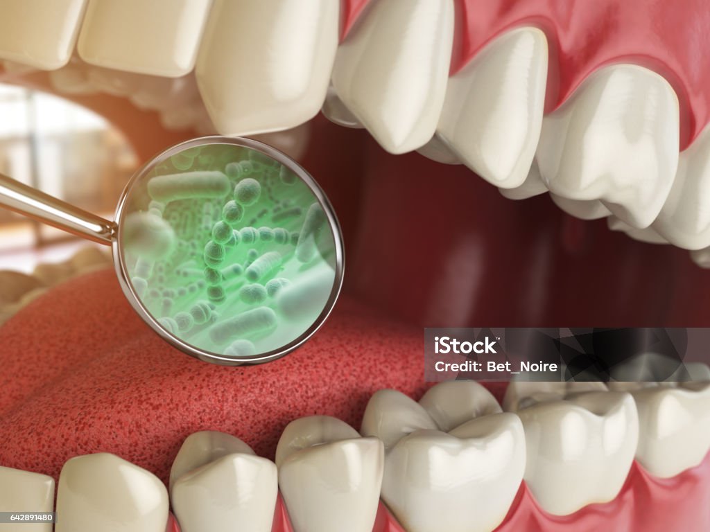 バクテリアや歯の周りのウイルス。歯科衛生士医療概念。 - 口のロイヤリティフリーストックイラストレーション