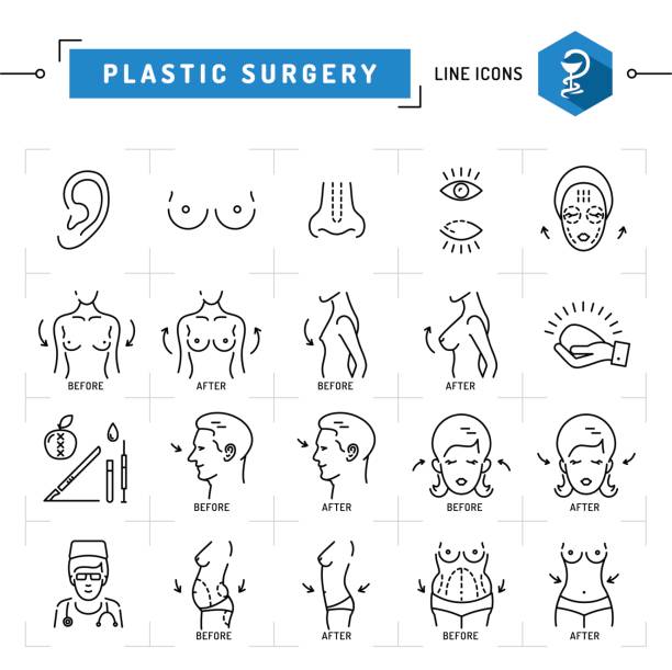 ilustrações, clipart, desenhos animados e ícones de ícones de linha fina preta de conceito de cirurgia plástica símbolos vetoriais médica - nose job illustrations