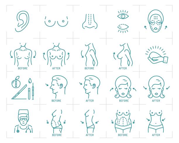 пластическая хирургия иконы увеличения груди, липосакция, блефаропластика, ринопластика и отопластика - nose job illustrations stock illustrations
