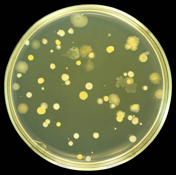 細菌 colonies ・エイガープレート上で分離ブラック - bacterial colonies ストックフォトと画像