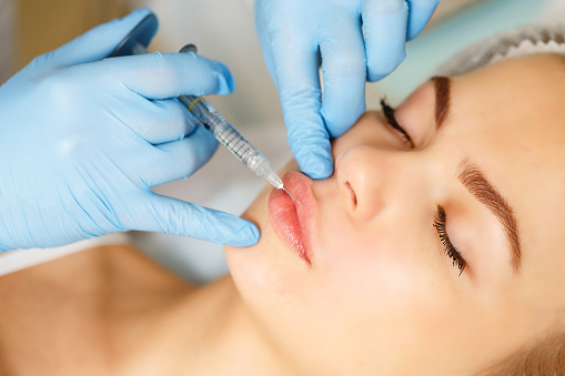 Injections of the lips. Correction form the upper lip. Injection of beauty. Spa. Facial Rejuvenation. Lip augmentation.