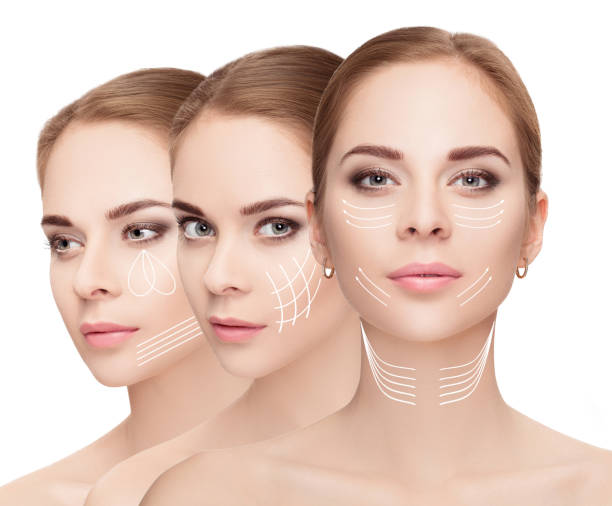 istock woman faces with arrows over white background. Face lifting con 644231264