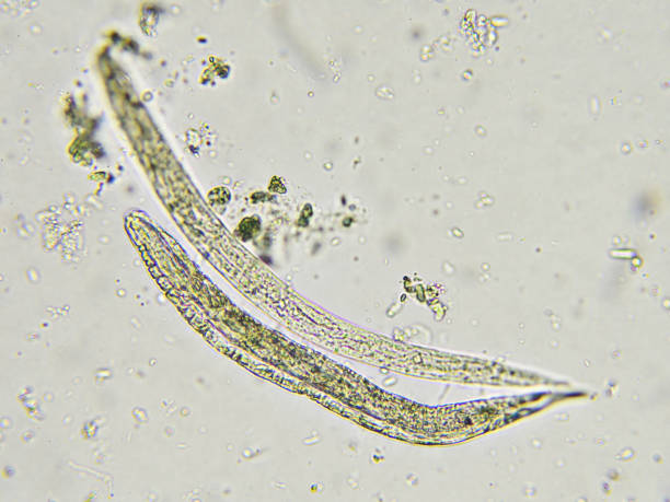 istock Strongyloides stercoralis (threadworm) 644393172