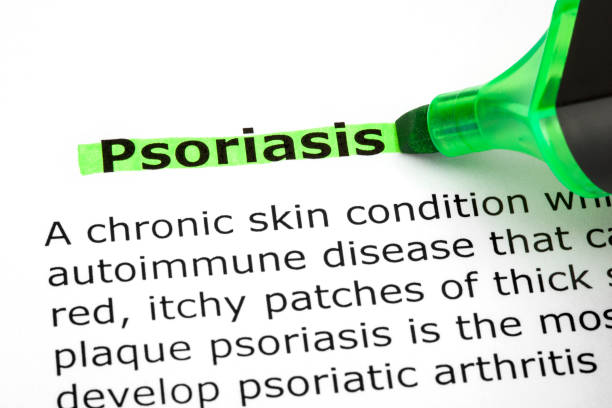 istock Psoriasis Highlighted With Green Marker 644569000
