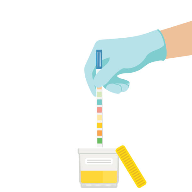 The doctor uses a urine test strip in the jar of urine. vector art illustration