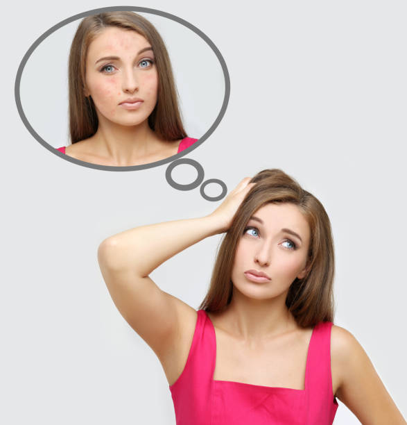 istock Rosacea.Girl with problem and clear skin. 645060186