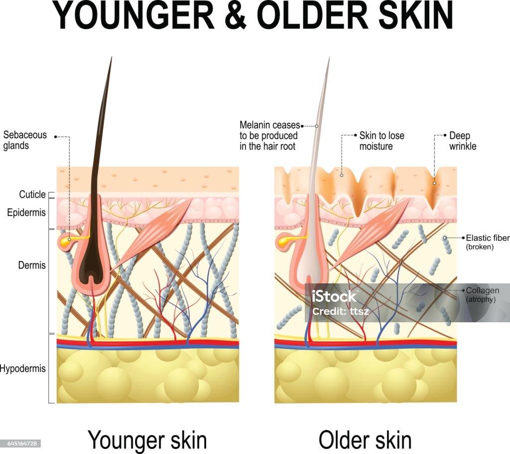 Skin changes or ageing skin. Human skin changes or ageing skin. A diagram of younger and older skin showing the decrease in collagen fibers, atrophy and broken elastin, formed wrinkles, hair becomes gray in the elderly. Skin stock vector