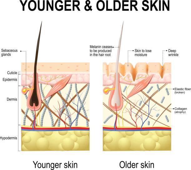 Skin changes or ageing skin. Human skin changes or ageing skin. A diagram of younger and older skin showing the decrease in collagen fibers, atrophy and broken elastin, formed wrinkles, hair becomes gray in the elderly. collagen stock illustrations